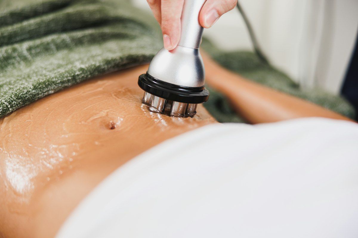 Cavitación en abdomen
